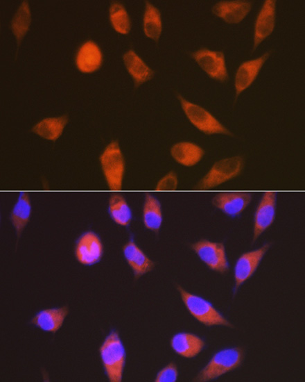LGR6 Rabbit monoclonal antibody