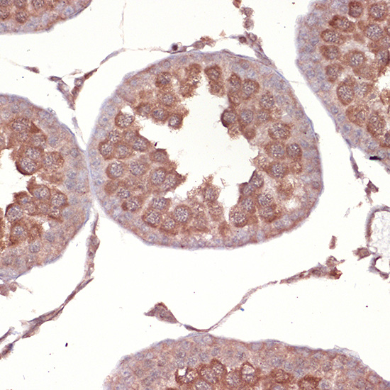 NCK1 Rabbit monoclonal antibody