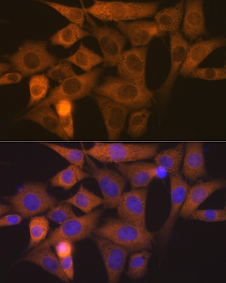 NCK1 Rabbit monoclonal antibody