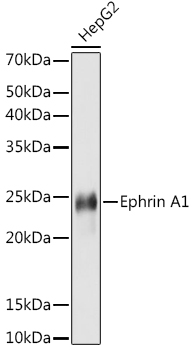 Ephrin A1 Rabbit monoclonal antibody