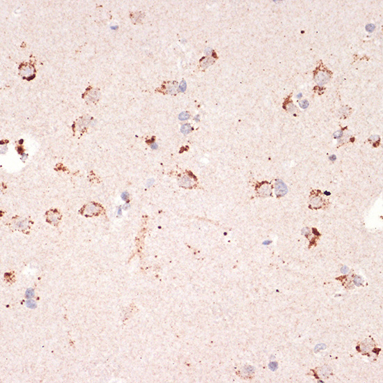 Ephrin A1 Rabbit monoclonal antibody