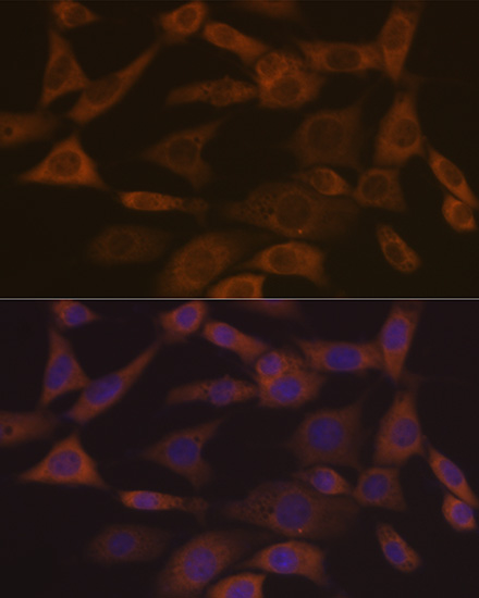 Ephrin A1 Rabbit monoclonal antibody