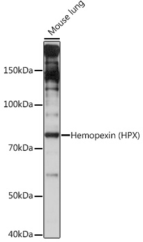 Hemopexin (HPX) Rabbit monoclonal antibody