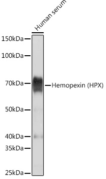 Hemopexin (HPX) Rabbit monoclonal antibody