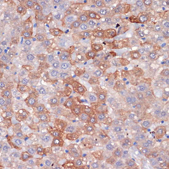 Hemopexin (HPX) Rabbit monoclonal antibody