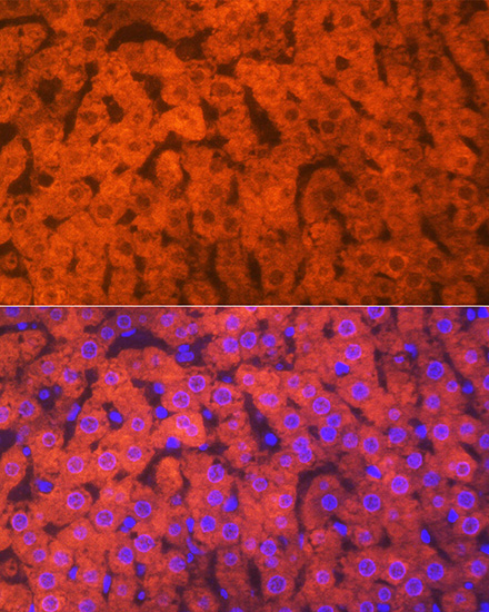 Hemopexin (HPX) Rabbit monoclonal antibody