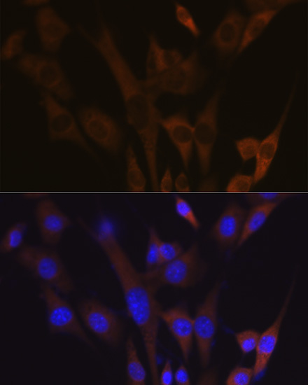 ABCE1 Rabbit monoclonal antibody