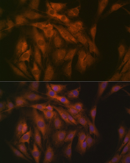 eIF3B Rabbit monoclonal antibody