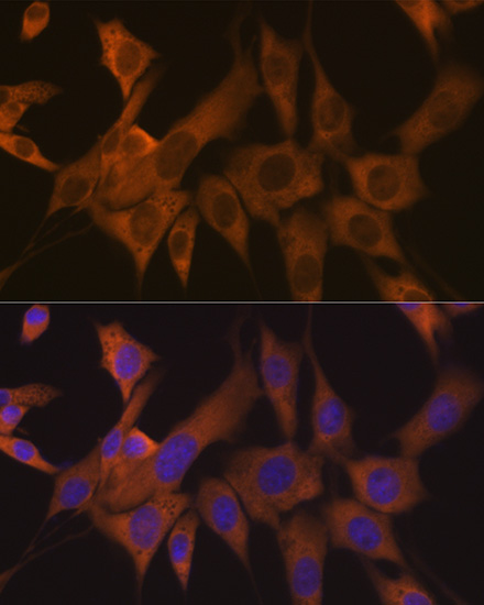 eIF3B Rabbit monoclonal antibody