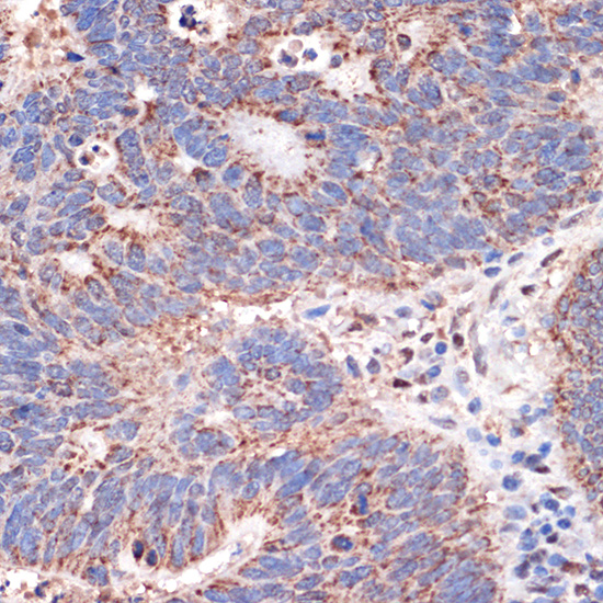 Prohibitin 2 (PHB2) Rabbit monoclonal antibody