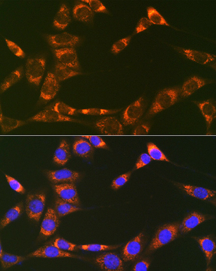 Prohibitin 2 (PHB2) Rabbit monoclonal antibody