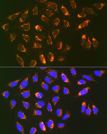 Prohibitin 2 (PHB2) Rabbit monoclonal antibody