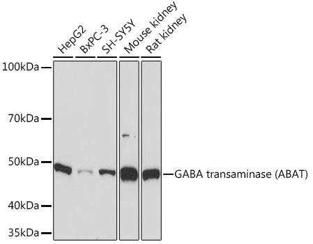 GABA transaminase (ABAT) Rabbit monoclonal antibody