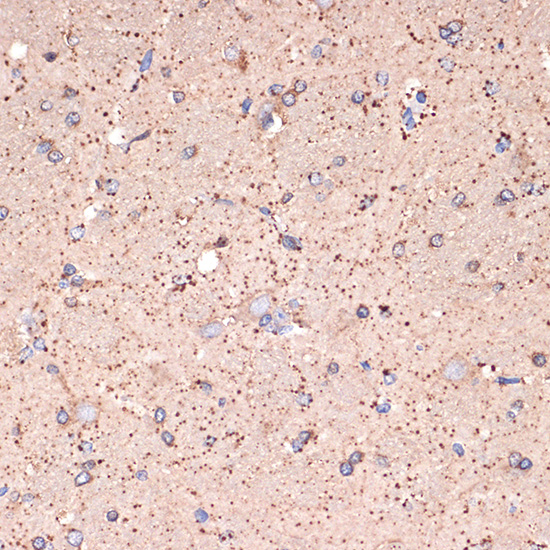 GABA transaminase (ABAT) Rabbit monoclonal antibody