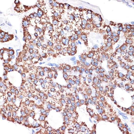 GABA transaminase (ABAT) Rabbit monoclonal antibody
