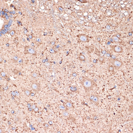 GABA transaminase (ABAT) Rabbit monoclonal antibody