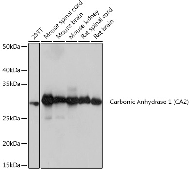 Carbonic Anhydrase 2 (CA2) Rabbit monoclonal antibody
