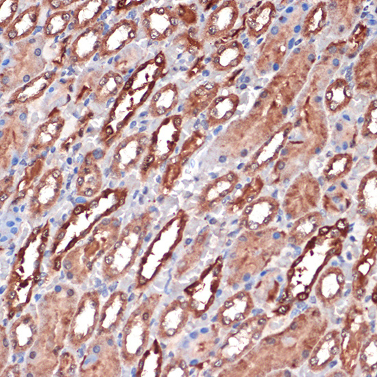 Carbonic Anhydrase 2 (CA2) Rabbit monoclonal antibody