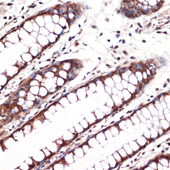 Carbonic Anhydrase 2 (CA2) Rabbit monoclonal antibody