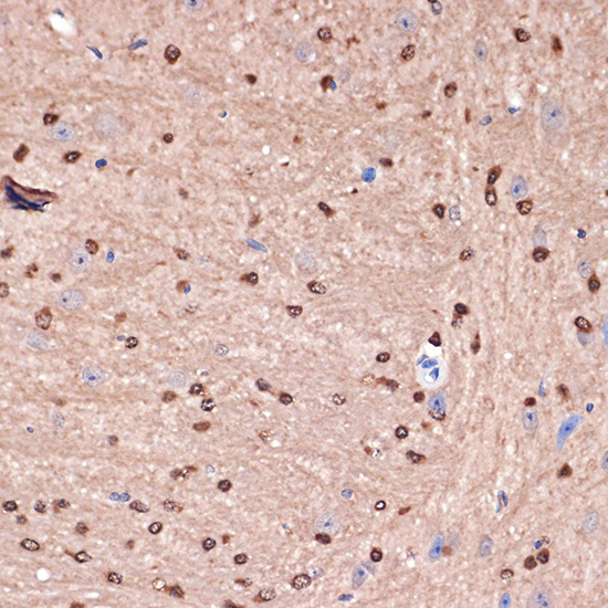 Carbonic Anhydrase 2 (CA2) Rabbit monoclonal antibody