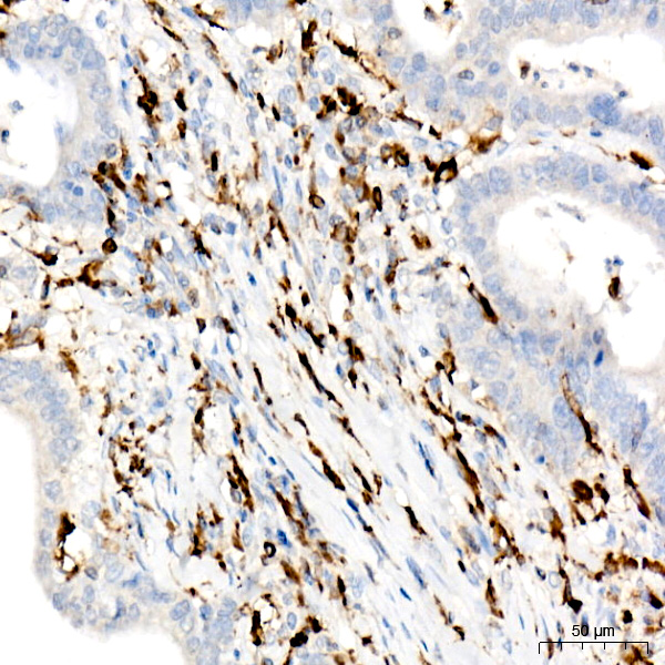 CD74 Rabbit monoclonal antibody