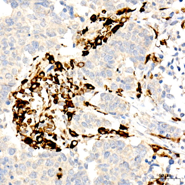 CD74 Rabbit monoclonal antibody