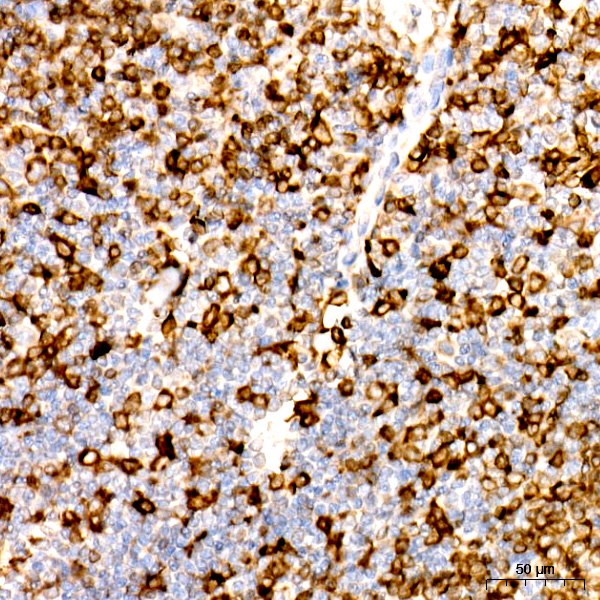 CD74 Rabbit monoclonal antibody