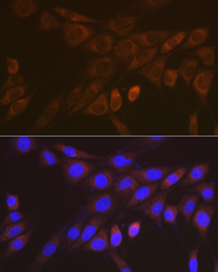 14-3-3 beta/zeta Rabbit monoclonal antibody