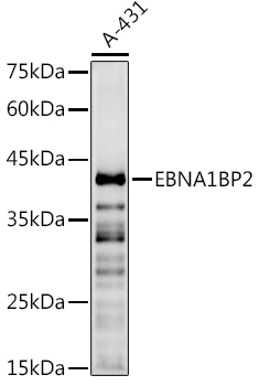 EBNA1BP2 Rabbit polyclonal antibody