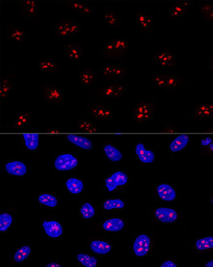 EBNA1BP2 Rabbit polyclonal antibody