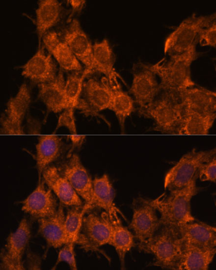 SNX15 Rabbit polyclonal antibody