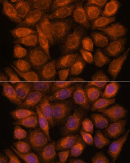 SNX15 Rabbit polyclonal antibody