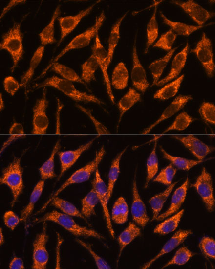 SNX15 Rabbit polyclonal antibody
