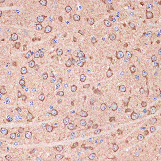 14-3-3 gamma Rabbit monoclonal antibody