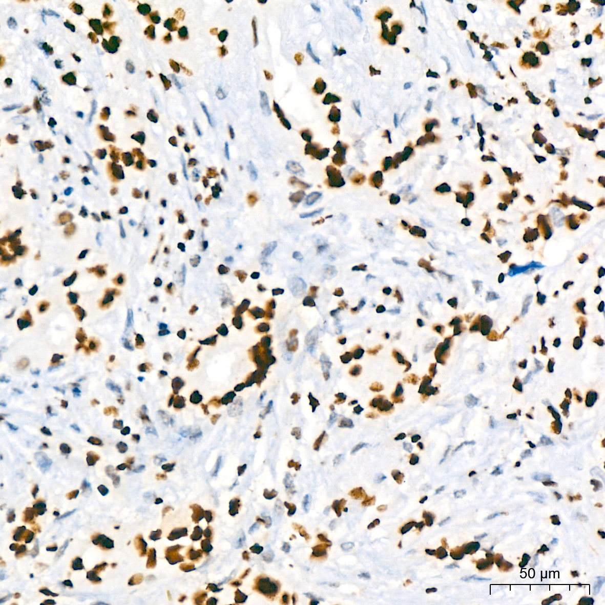 HMGB2 Rabbit monoclonal antibody