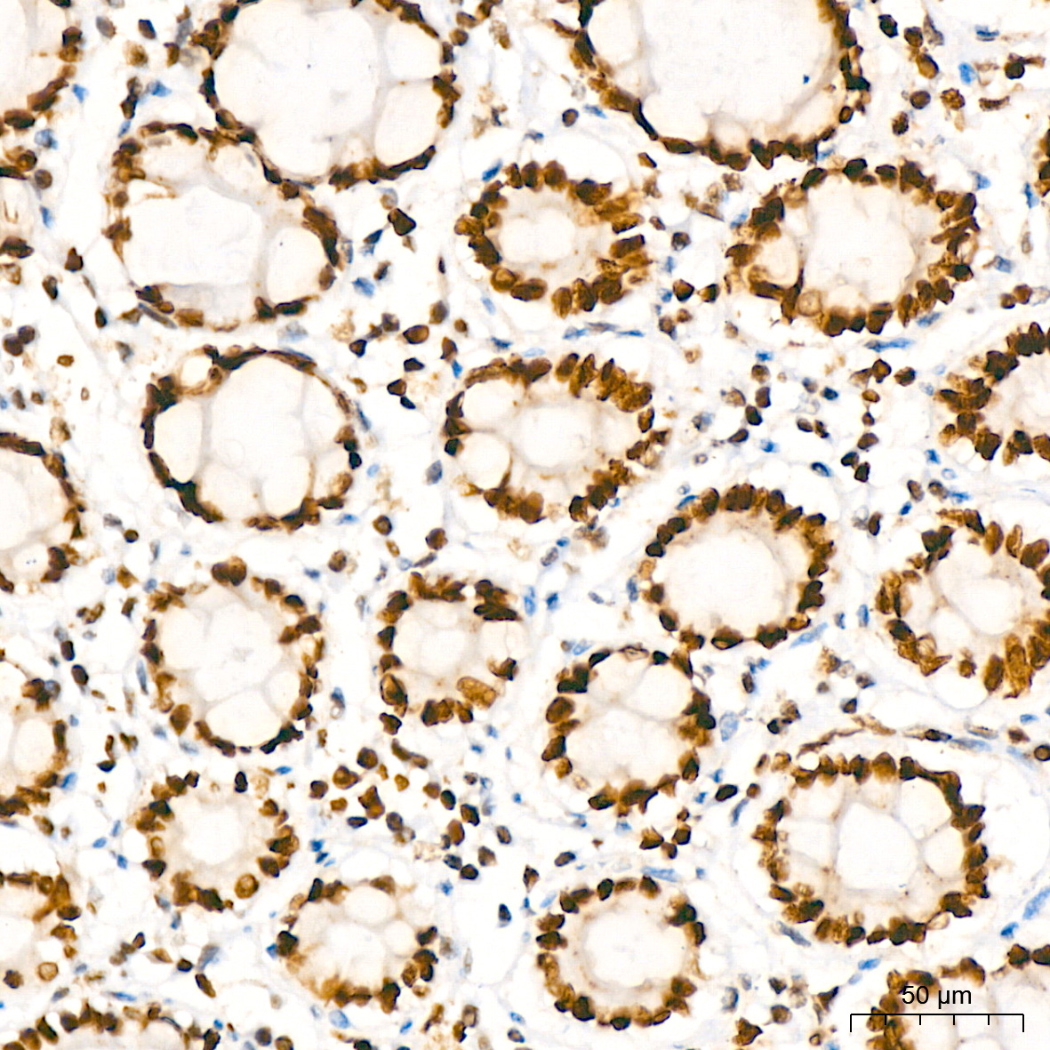 HMGB2 Rabbit monoclonal antibody