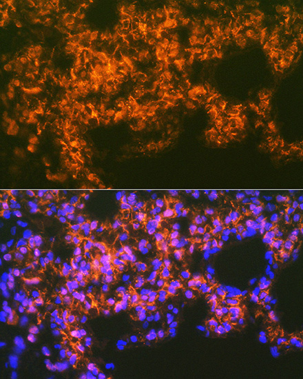 Mesothelin Rabbit monoclonal antibody