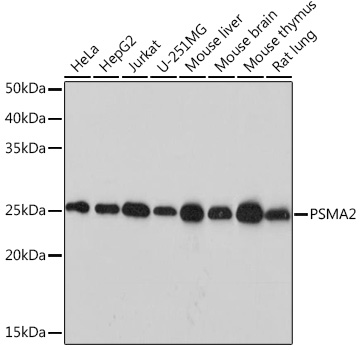 PSMA2 Rabbit monoclonal antibody