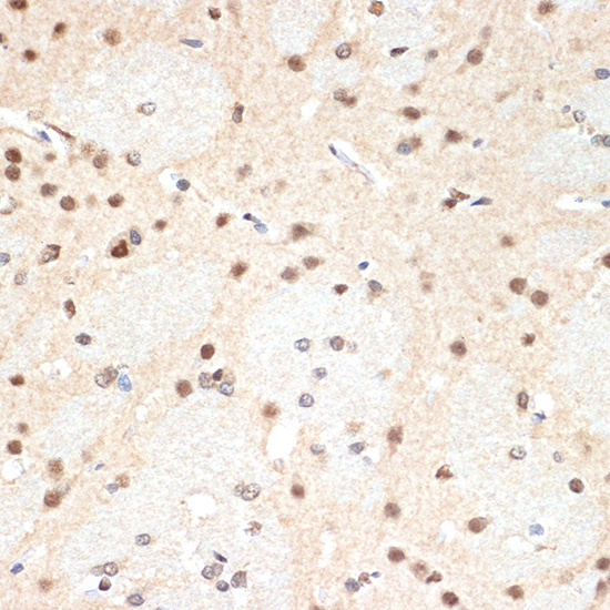 PSMA2 Rabbit monoclonal antibody