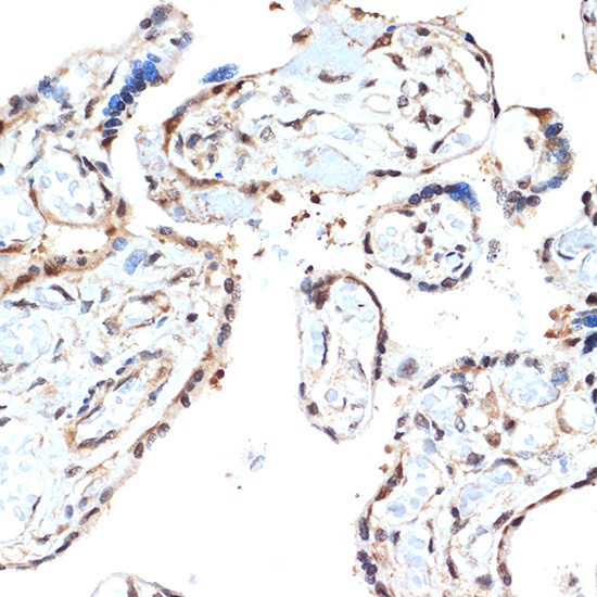 PSMA2 Rabbit monoclonal antibody