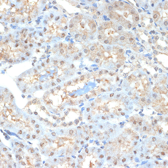 PSMA2 Rabbit monoclonal antibody
