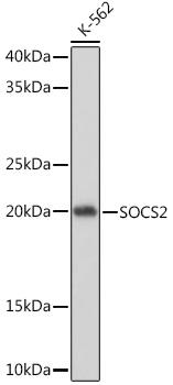 SOCS2 Rabbit monoclonal antibody