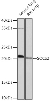 SOCS2 Rabbit monoclonal antibody