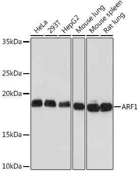 ARF1 Rabbit monoclonal antibody