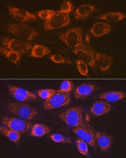 ARF1 Rabbit monoclonal antibody