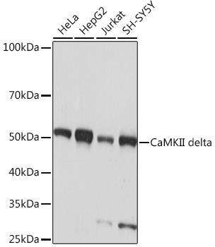 CaMKII delta Rabbit monoclonal antibody