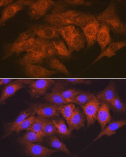 CaMKII delta Rabbit monoclonal antibody