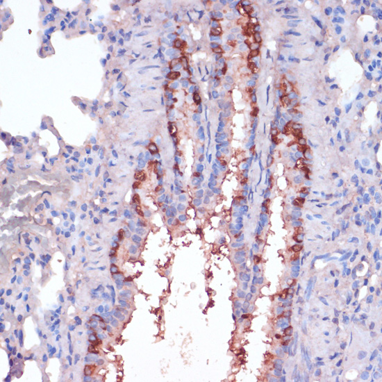 [KO Validated] RPL22 Rabbit polyclonal antibody
