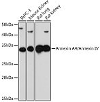 Western blot - Annexin A4/Annexin IV Rabbit mAb (A9203)