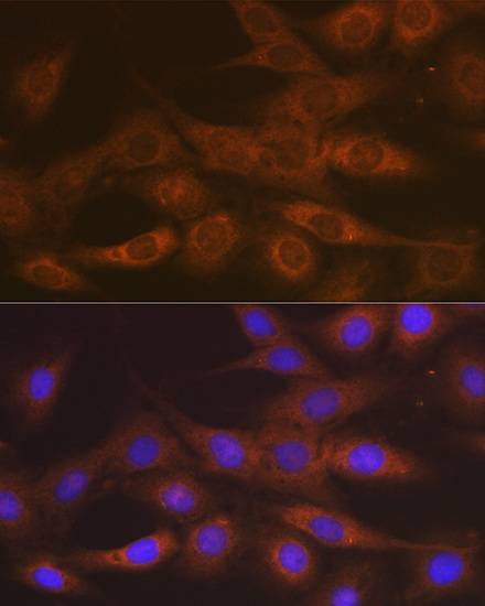 [KO Validated] IMPDH2 Rabbit monoclonal antibody